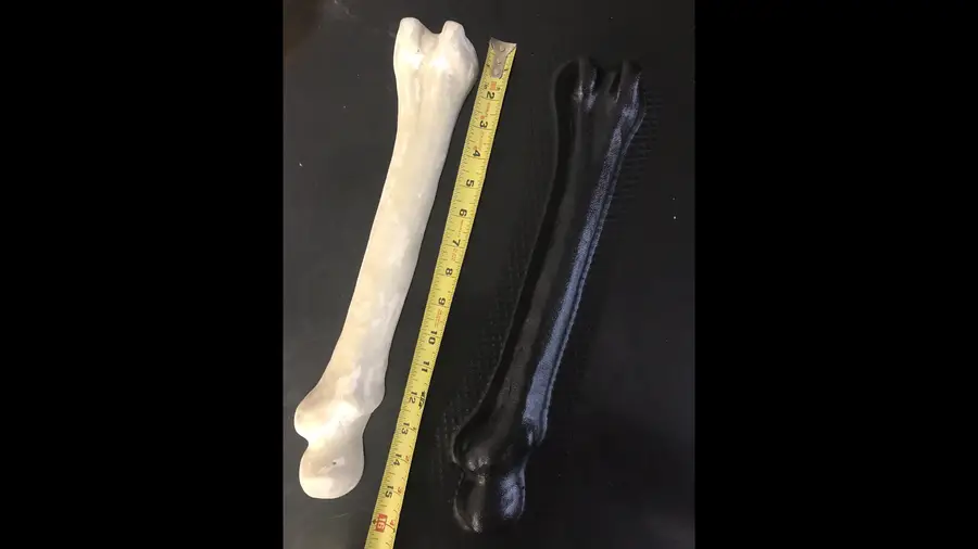 Femur Bone 16